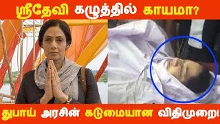 ஸ்ரீதேவி கழுத்தில் காயமா! துபாய் அரசின் கடுமையான விதிமுறை! | Kollywood News | Tamil Cinema