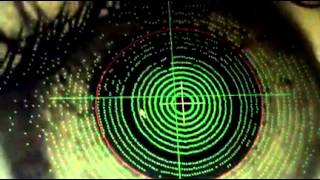 Zeiss Humphrey Atlas 995 Corneal Topographer