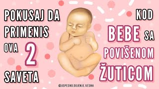 KAKO RAZBUDITI BEBU KOJA IMA ŽUTICU?Saveti u vezi dojenja