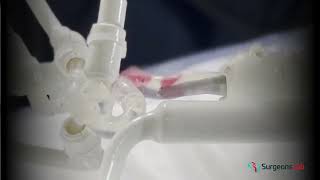 Elevate Your Thrombectomy Skills: SurgeonsLab CathTrain Simulation Training | SurgeonsLab AG