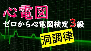 心電図 ゼロから心電図検定3級【洞調律】