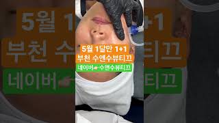 리쥬란힐러 보다 안아프지만 효과좋은 물광관리가 있다면?!