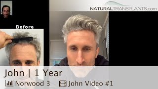 Receding Hairline Hair Transplant Results with Natural Transplants | Dr. Blumenthal (John)