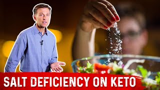 Symptoms of Salt Deficiency On Keto Diet – Dr. Berg