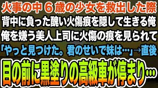 【感動する話】火事の中6歳の少女を救出した際背中に負った醜い火傷痕を隠して生きる俺。俺を嫌う美人上司に火傷の痕を見られて「やっと見つけた。君のせいで妹は」→目の前に黒塗りの高級車が停まり…