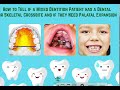 dental vs skeletal crossbite in a mixed dentition patient should you expand