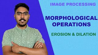 Morphological Operations | Erosion and Dilation - Solved Example | Image Processing