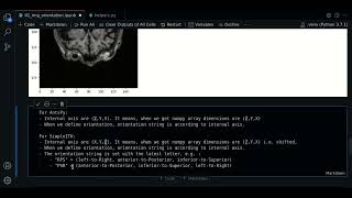 1.1 - MRI image orientation with SimpleITK - Course MRI preprocessing with Python