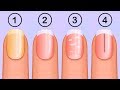 5 Things That Your Nails Say About Your Health 5 Things That Your Nails Say About Your Health