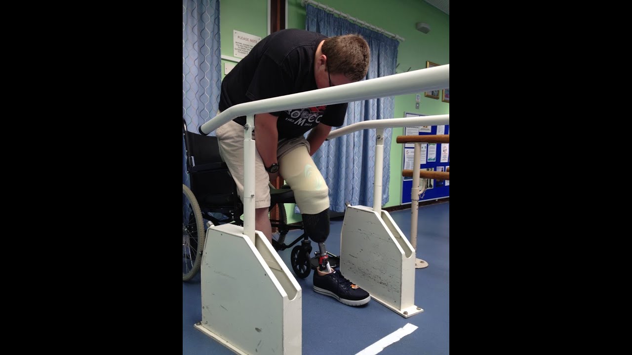 Learning To Walk On My First Prosthetic Leg - YouTube