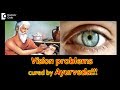 Can Short sight or Long sight be cured by Ayurveda? - Dr. Prajwal Narayan