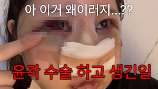 성형 수술 부기 이렇게 뺐어요😂🤣 달리는 차에서 일어난 일 [혜주Vlog]