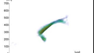 X-ray topo-tomography