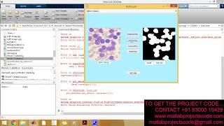 Detection and counting of blood cells using image segmentation A review