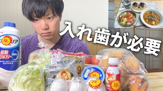 【絶望】30歳で入れ歯(義歯)を勧められた歯とは【元無職/フリーター】