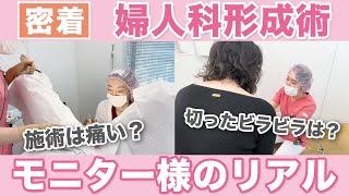 【密着】婦人科形成術のリアル