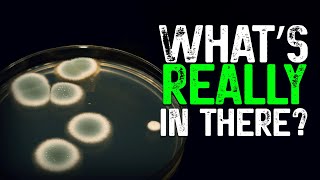 Contamination in mycology: where does it come from?