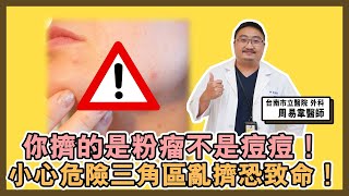 你擠的是 #粉瘤 不是 #痘痘！小心 #危險三角區 亂擠恐致命！【達特543】| 黃丹尼 ft. 台南市立醫院 外科 周易韋醫師【543男方基地】