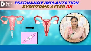 4 Signs of IMPLANTATION after IUI | Pregnancy Implantation Symptoms -Dr.Sneha Shetty|Doctors' Circle