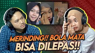 VIRAL!! BOLA MATANYA BISA DILEPAS!! GHINA DIBULLY HINGGA HAMPIR BUNUH DIRI!!