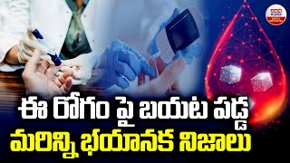 ఈ రోగం పై బయట పడ్డ మరిన్ని భయానక నిజాలు | Scariest Disease in Humans | ABN Digital