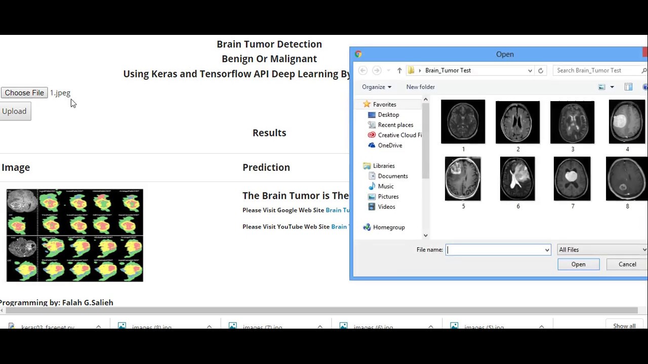 Brain Tumor Detection Web App.(Benign Or Malignant) - YouTube