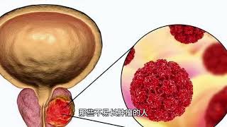 最新研究发现：不易长肿瘤的人，大都有 3 个共性，你占了几条