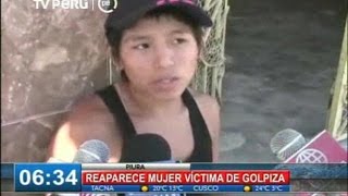 Mujer golpeada en Piura se niega a denunciar a agresor