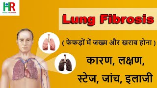 Lung fibrosis in hindi || lung फाइब्रोसिस क्या होता है || lung फाइब्रोसिस के लक्षण, कारण, जाँच, इलाज