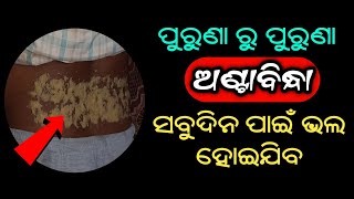 ପୁରୁଣା ରୁ ପୁରୁଣା ଅଣ୍ଟାବିନ୍ଧା ସବୁଦିନ ପାଇଁ ଭଲ ହୋଇଯିବ | Home Remedy for Back Pain in Odia