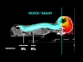 How does proton therapy work? See the difference of proton and conventional radiotherapy