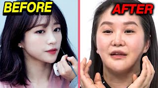 Kpop Idols Who DESTROYED Their Looks After Beauty Procedures