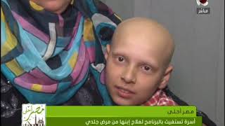 مصر أحلى | أسرة تستغيث بالبرنامج لعلاج إبنها من مرض جلدي