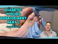 Diabetic Wound Debridement - Part 3 - Podiatry Explained with Dr. Roger Kilfoil