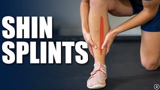 Shin Splints | Medial Tibial Stress Syndrome (Exercises, Rehab, Strengthening)