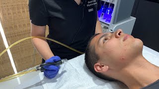 DermalInfusion | Skin Resurfacing | West Hollywood, CA | Dr. Jason Emer