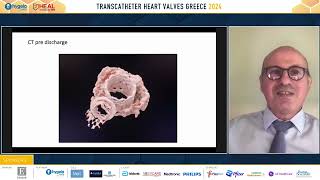 K. Spargias | Transcatheter mitral valve interventions: A 20-year journey