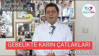 GEBELİKTE KARIN ÇATLAKLARI GENETİK Mİ? ENGELLEMEK İÇİN HANGİ ÜRÜNLER KULLANILMALI,NE ÖNLEM ALINMALI?