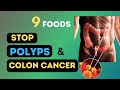 9 Miracle Foods to Eliminate Colon Polyps & Stop Bowel Cancer