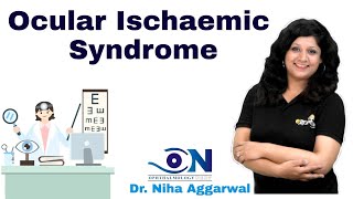 Ocular Ischaemic Syndrome || Dr. Niha Aggarwal