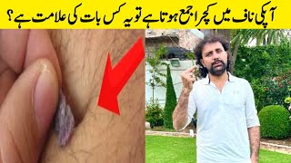 What causes navel / belly button stone or dirt | Omphalolith | Umbilicolith | Health | Jabir Bangash