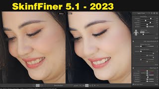 Review SkinFiner 5.1 update 2023 | chiasepts