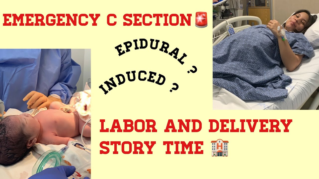 Teen Mom Labor Delivery Story Time Emergency C Section Pregnant