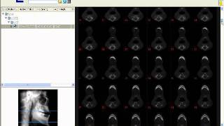 Processing -- Loading Dicom3 Images