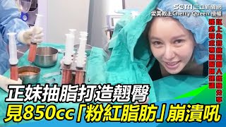 手術畫面曝！正妹抽脂打造翹臀　見850cc「粉紅脂肪」崩潰吼｜三立新聞網SETN.com