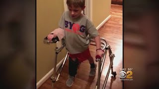 New Surgery Helps Child Paralyzed By AFM