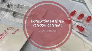 CONEXIÓN CATETER VENOSO CENTRAL A HEMODIÁLISIS