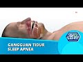 Gangguan Tidur Sleep Apnea, Seperti Apa Itu? | AYO SEHAT