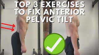 Top 3 Exercises To Fix Anterior Pelvic Tilt For Good