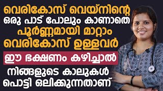 വെരികോസ് വൈൻ ഉള്ളവർ ഒരിക്കലും കഴിക്കാൻ പാടില്ലാത്ത ഭക്ഷണങ്ങൾ ഇതൊക്കെയാണ് | VERICOSENVEIN MATTAM